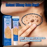 Ubat ketuat skin tag remover mole remover wart removal ketuat remover ubat ketuat paling berkesan