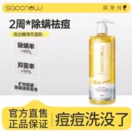 🏠Sulfur AntiMite Shower Gel Mite Removal Acne Control Deep Cleansing Liquid Soap Women Men 硫磺除螨沐浴露去螨虫祛痘痘深层清洁止痒洗发水女男士液体香皂