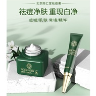 {SG Seller} 北京同仁堂草本祛痘膏 Acne Removal Cream Acne Removal Acne Students Dilute Acne Marks Acne Repair Remove Acne