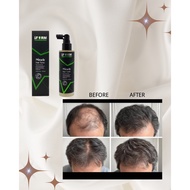 IFORM Miracle Hair Tonic (120ml) Anti Hair Loss Dandruff Scalp Care Tonic Rambut Gugur Malay Friendl