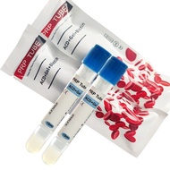 PRP Tubes with Separation Gel ACD Gel for Face & Hair