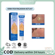Ubat Ketuat Tapak Kaki Ubat Mata Ikan Penampal Ketuat Wart Remover Cream Krim Penghilang Ketuat