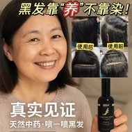 Dr Hair 黑发精华液🙍🏻‍♀️ V&W The Hair Care Shop Ginseng Herbal Essence Mehitamkan rambut 白发生黑发