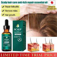 【Hot Sale】[Repair Folliculitis/Remove Mites/Hair Growth] Scalp Hair Care Essential Oil Strong Roots 