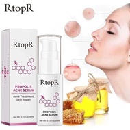 Rtopr Repair Acne Brightening Serum Acne Scar Spots Cleaning Serum Shrink Pores Eliminates Acne