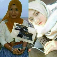 QM TRIPLE TURBO WHITENING BOOSTER