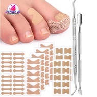 [DynwaveedMY] Ingrown Toenail Correction Patch Versatile Efficient Ingrown Toenail Strips