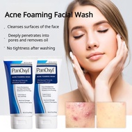 Deep Cleansing Peroxide Facial Wash Facial Wash Deep Cleansing Facial Wash Peroxide Deep Cleansing