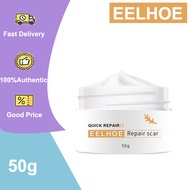 EELHOE Old Scar Remover for Legs 50g Peklat Remover Acne Surgical Stretch Marks Repair Cream Gel