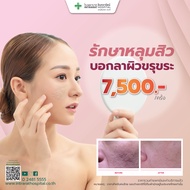 [E-coupon]  Discovery Pico Laser หลุมสิว ริ้วรอย จุดด่างดำ ฝ้า กระ ผิวไม่เรียบเนียน ( เลเซอร์หลุมสิว