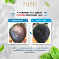 Obat Penumbuh Rambut Serum Penumbuh Rambut Penumbuh Rambut