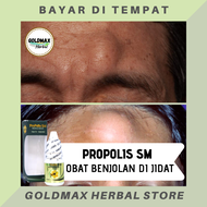 Propolis SM Obat Benjolan Di Jidat - Obat Untuk Menghilangkan Benjolan Di Jidat - Obat Benjolan Di D