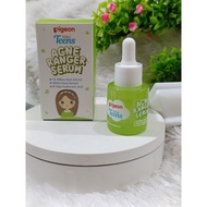 Pigeon Teens - Serum