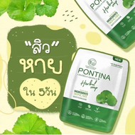 Pontina Centella เซรั่มใบบัวบก กู้ผิว พรทิน่า พรทิน่า สบู่ใบบัวบก