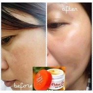 Pekas Melasma Remover Cream Toner Soap