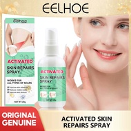 Eelhoe Scar Removal Spray Repair Stretch Mark Burn Surgical Acne Scars Treatment Smoothing Tightening Firming Whitening Body Skin Care Scar Remover Spray Repair Stretch Mark Firming Body Treatment Streak Improve Smooth Skin Promote Collagen Care