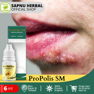 Obat Herpes Bibir Herpes Mulut Bintik Bintik Putih Di Bibir Luka Melepuh Sekitar Bibir Herpes Simple