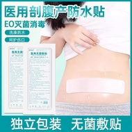 2025 New Style Cut Belly Production Medical Wound Waterproof Sticker Bath Cut Belly Production Water