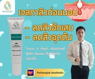 เจลทาสิว 20มล 0.1% Adapalene gel 20ml