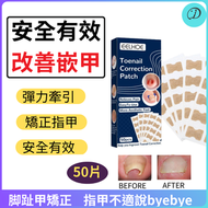 EELHOE 甲溝嵌甲正甲貼 正甲貼 甲溝嵌 甲矯正器 腳趾甲貼 趾甲貼片 腳趾矯正器 指甲貼 指甲矯正貼 正甲貼 甲溝嵌甲矯正器 腳溝腳趾趾甲貼片 指甲長肉裡 凍甲