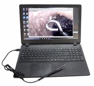 Camera nội soi tai mũi họng camera mini nội soi kết nối điện thoại kết nối bluetooth cho hình ảnh s