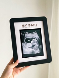 Early Pregnancy B-Scan Four-Dimensional Color Ultrasound Photo Frame Baby 3D Early 24 Weeks Gift for