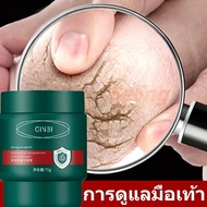 Cracked Heel Cream Foot Scrubber Feet Hand Care Exfoliate Dry Rough Skin