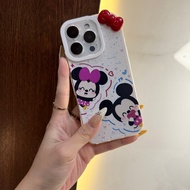 TM875 For OPPO Find X8 Ultra X7 X6 X5 X3 X2 Pro Lite Neo Reno 14 13 13F 12 12F 11 11F 10 9 8 8T 8Z 7