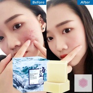 Sea Salt Soap Pores Whitening Blackhead Removal Face Wash Health Care / Sea Salt Soap Natural Goat Milk in Addition to Mites Soap Washing Lovely goblin sea salt mite removal makeup oil control sulfur face wash