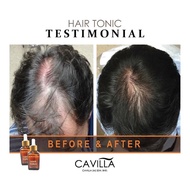 [ RESULT!!️] Cavilla Hair Tonic睫毛增长液生发液 !️