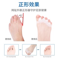 A/💎Thumb Valgus Finger Splitter Big Toe Hallux Valgus Toe Separator Fixed Toe Separator Adult 【One-pair package】Five Rin