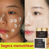 cream penghilang flek hitam salep melasma flek hitam membandel 50g cream flek dan kusam bpom/Remove 