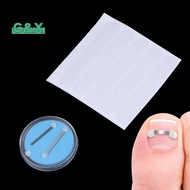 [G&X] Ingrown Toenail Recover Pedicure Tool Toe  Toenail Straightener Toenail Fixer Bunion Corrector