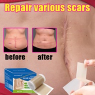 silicone scar tape scar sheet silicone scar patch Medical scar removal patch keloid scar plaster kel