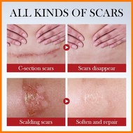 ∽ ✬ ▘ Scar Removal Cream 20g Stretch Marks Peklat Remover Cream For Face Arms Legs Acne Repair Old