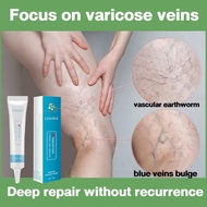 Varicose Vein Cream Varicose Vein Treatment Cream Varicose Veins Remover Cream Promote blood circula