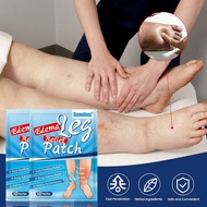 10PCS EDEMA LEG RELEIF PATCH Tampalan Pelega Kaki Edema Penghilang bengkak edema Mengurangkan kerada