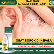 Obat Borok di Kepala Psoriasis Kulit Kepala Salep Kulit Kepala Berjamur Gatal Bernanah Gatal Kulit K