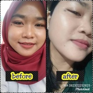 (Cod)Nanotera Skincare (Paket Freeserum Aa Dan Pouch Cantik Nanotera).