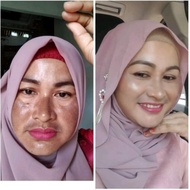 PAKET FLEK DRW SKINCARE CREAM KHUSUS KELUHAN FLEK MENGHASILKAN FLEK HITAM YANG MEMBANDEL DAN MENAHUN . BOOSTER FLEK PALING AMPUH CREAM FLEK DAN BINTIK HITAM