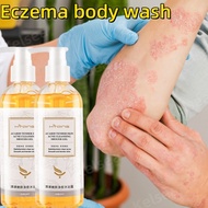 sabun gatal kulit eczema eczema body wash eczema treatment Gatal Kulit treatment eczema psoriasis Ri