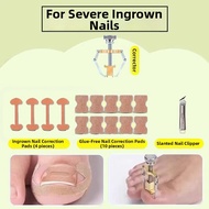IMLUCKY | Ingrown Toenail Correction Pads