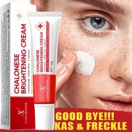 Whitening Blemish Flek Hitam Penghilang Flek Hitam Original Magic Glow Cream Anti Freckle Salep Mela