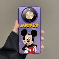Honor X9d 5G HONOR X9d Premium Plastic Disney Case Cute Mickey Case Hard Cover