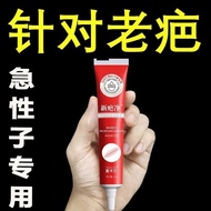 [Suitable for the impatient] Surgical wound unevenness and scar removal old scars falls burns hyperplasia cream acne marks for children