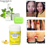 Fern D + Aurora Soap + Aurora Lotion ( Treatment for Psoriasis ) - GodsFavorBoutique