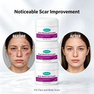 Ouhue Scar Removal Cream   Lightening Cream Post Injury Recovery Essence Uneven Skin Tone Repair Car
