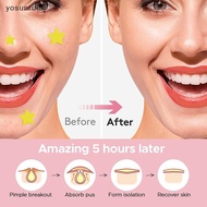 yosunrui5j] 456pcs Colorful Star Pimple Patch Acne Colorful Invisible  Skin Care Stiers Concealer Fa