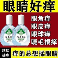Spring Allergies Eye Itch Drops Eye Lotion Relieve Allergies Itchy Seasonal Itchy Eye Cuticles Itchy