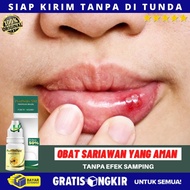 [ BOLEH DI TELAN ] Obat Sariawan Yang Aman Untuk Anak || Obat Oles Luka Sariawan Obat Sariawan Alami